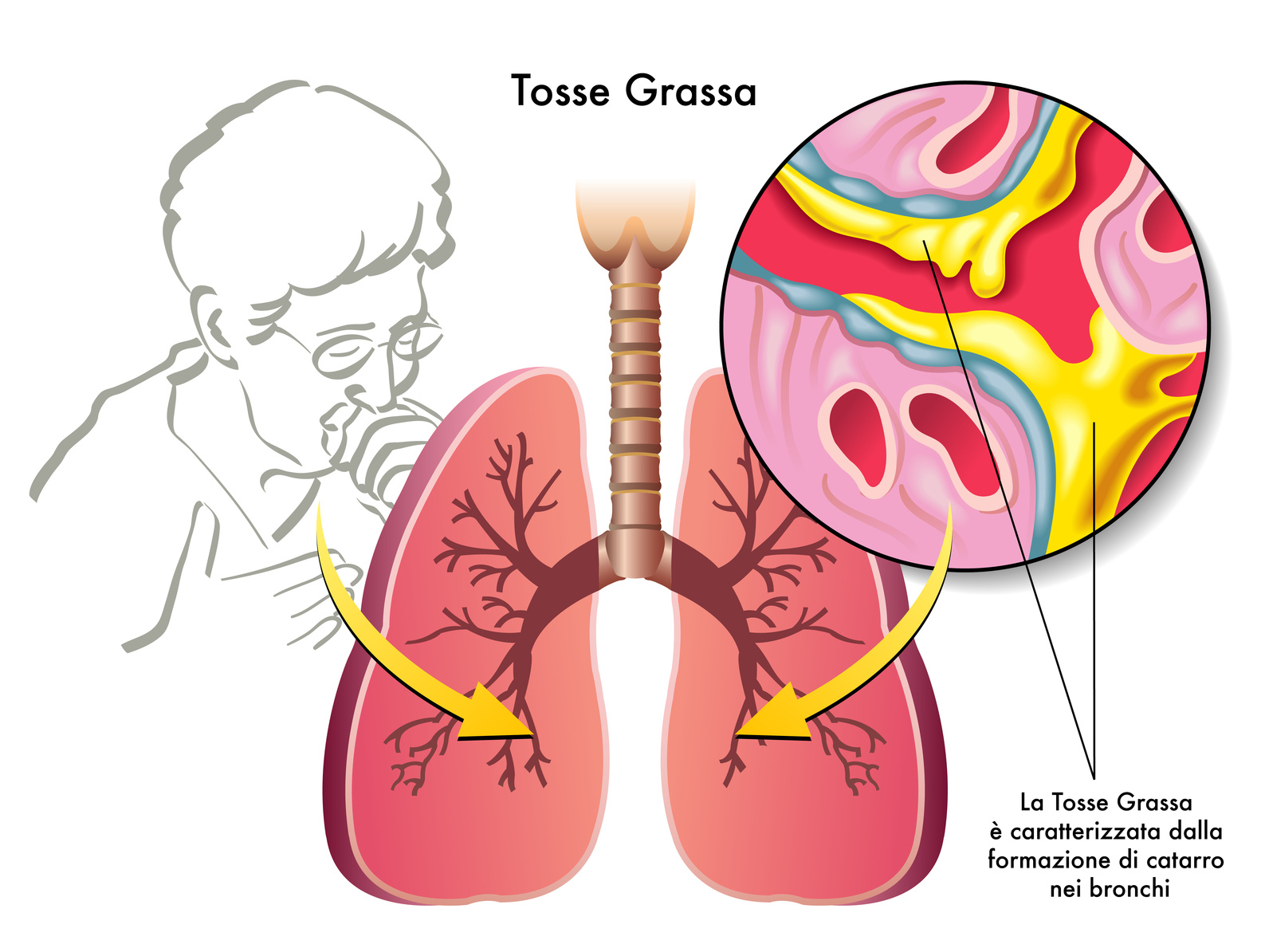 lungs-yellow-mucus-from-lungs