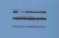 Autoradiography Film