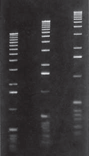 Agarose LE gel in 1X TAE buffer 
From Right to Left
Lane 1 -0.75 %
Lane 2 -1 %
Lane 3 -1.25 %

Marker: 1 Kb Ladder.