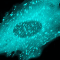 mTFP1-Vinculin