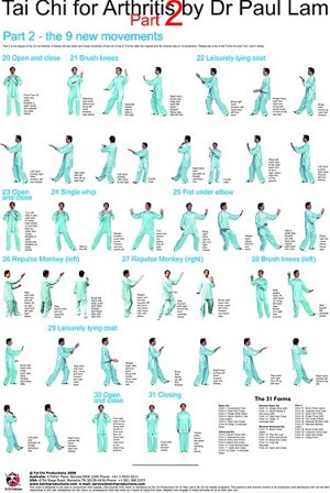 Arthritis Chart