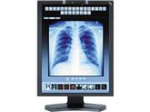 NEC Display Solutions MD211C3 Black 21.3" 20ms (GTG) Widescreen LED Backlight Medical Diagnostic Monitor