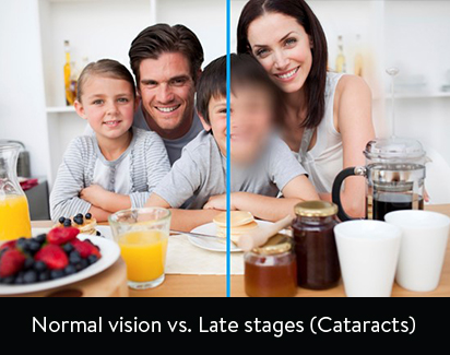 page-cataracts-sub.jpg