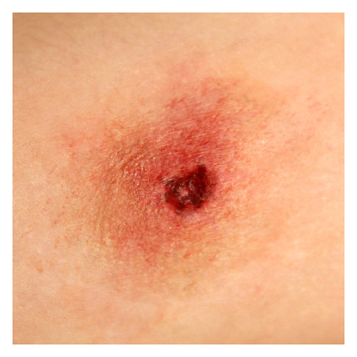 9mm Caliber Bullet Hole Entry Wound Mold