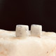 8mm scattered silver flecks