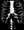 Skelly