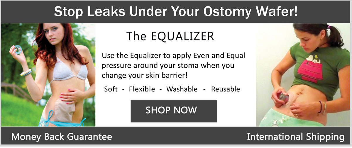 Stomaplex Ostomy belts and Stomaplex Stoma Guards for women and girls with an ostomy who are looking to stay active and be confident with their lives.
The stomaplex ostomy belt and stoma guard protects the stoma while maintaing a low profile.
If you are looking for ostomy clothing, consider the stomaplex ostomy belt and stoma guard.
The Stomaplex Equalizer is a great tool to extend the life of your ostomy wafer by applying pressure on the ostomy skin barrier The active lifestyle in you will appreciate the Stomaplex ostomy belt and stomaplex stoma guard that is designed for the ostomate with an active life.