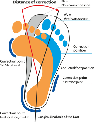 Footcare & Footwear - Childrens Footwear/orthotics - Anti-varus (AV ...