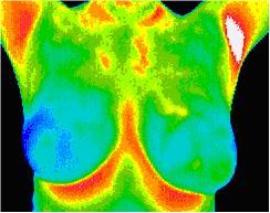 breast-thermography.jpg breast-thermography.jpg
