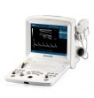 Edan D60 ultrasound imaging system with 1 probe 