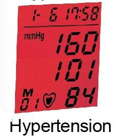BP101W Digital arm Talking blood pressure monitor Large LCD, Extra