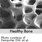 healthy-bone.gif