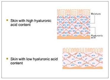 hyaluronic-acid.png hyaluronic-acid.png
