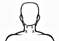 tens unit neck pain｜TikTok Search