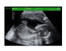Fake Pregnancy Fake Sonogram with Green Bars