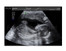 Fake Pregnancy Fake Sonogram with Clear Bars