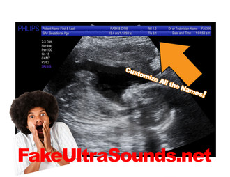 2D Fake Ultrasound Sonogram with Personalization!