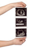 Actual Fetus Image on the Fake Ultrasound will change depending on the version you choose. 