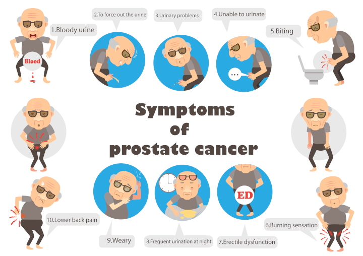 15-prostate05.jpg 15-prostate05.jpg