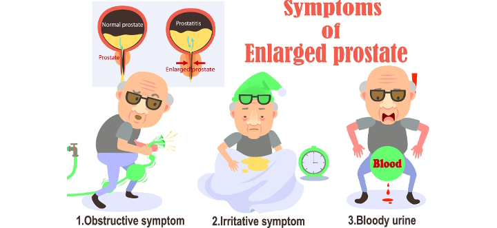 15-prostate08.jpg 15-prostate08.jpg
