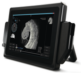 Sonomed VuPad Portable Ophthalmic Ultrasound