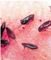 flea-bites.png
